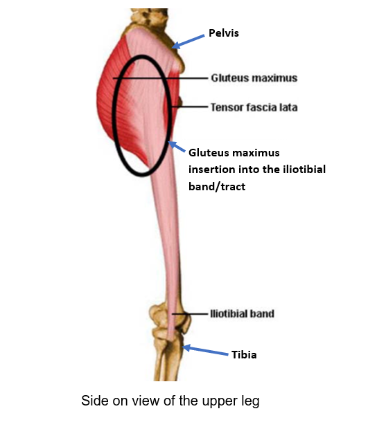Extraphyseal iliotibial band techniques. (A) The iliotibial band