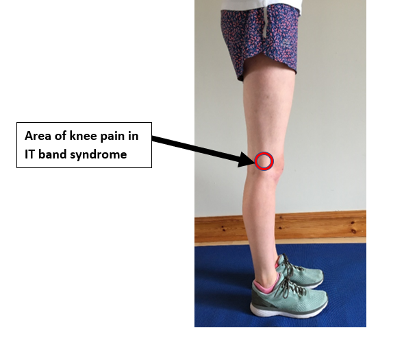 Running With IT Band Syndrome